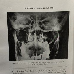 Radiographie bucco-dentaire et agents physiques en stomatologie -...