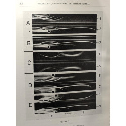 Les globulines sériques du système gamma leur nature et leur...