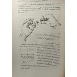 Prothèse dentaire conjointe --- Inlays Onlays couronnes et bridges...