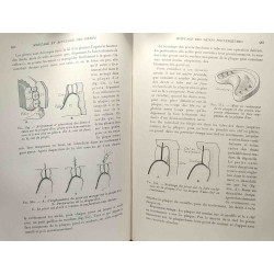 Prothèse dentaire amovible - TOME V - la ptratique stomatologique