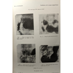 Les syndromes douloureux de la région épigastrique (étude clinique...