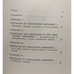 Amygdales et végétations adénoïdes de la cause au traitement naturel