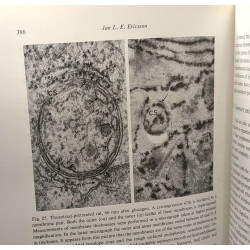 Lysosomes in Biology and Pathology TOME 2 (1969) + TOME 3 (1973) /...
