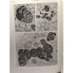 Lysosomes in Biology and Pathology TOME 2 (1969) + TOME 3 (1973) /...