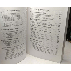 Sauvez vos os : L'ostéoporose prévention et alimentation