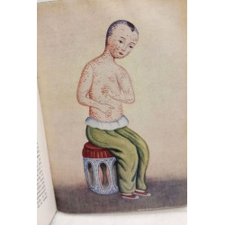 L'homme contre les microbes les maladies contagieuses dans...