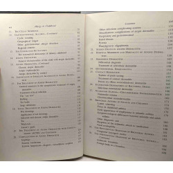 Allergy in childhood