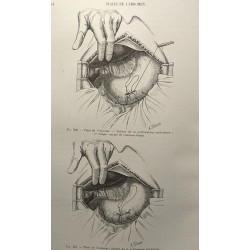 Traité de chirurgie d'urgence - TOME I + TOME II - 9e éd....