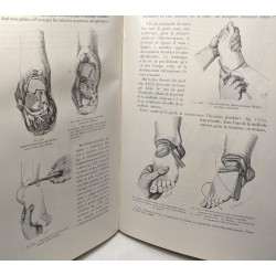 Traité de chirurgie d'urgence - TOME I + TOME II - 9e éd....