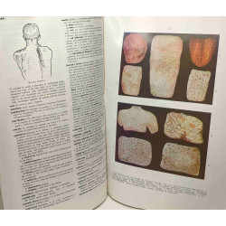Stedman's medical dictionary - 19th revised edition
