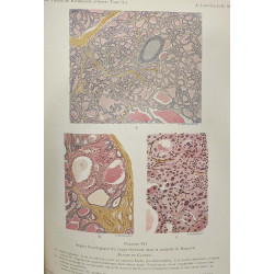 Nouveau traité de pathologie interne - TOME 1 (Deux volumes 1926)...