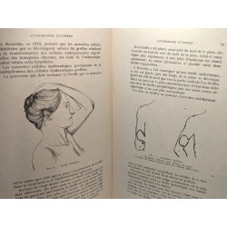 Les greffes chirurgicales