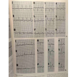Les examens complémentaires non invasifs en cardiologie