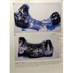 Principles of Bone Biology