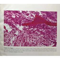 Principles of Bone Biology