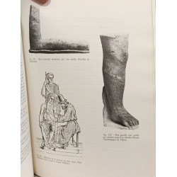 La medecine romaine : l'art d'esculape dans la rome antique +...