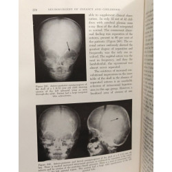 Neurosurgery of Infancy and Childhood