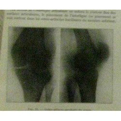 Diagnostic chirurgical - collection de précis médicaux en quatre...