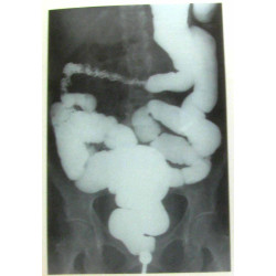 Guide pratique de la constipation