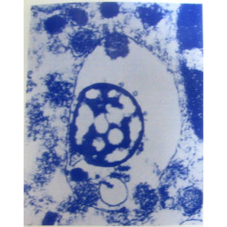 Les macrophages et l'infection ? le systeme phagocytaire mononuclee