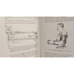 Traité des fractures des membres: examen clinique radiographie...