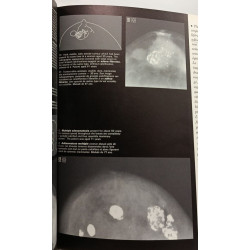 Les Images Mammographiques