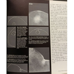 Les Images Mammographiques