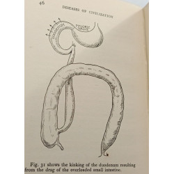The Prevention of the Diseases Peculiar to Civilization