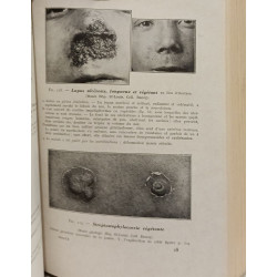 Traitement des dermatoses communes