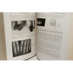 Traitement des dermatoses communes